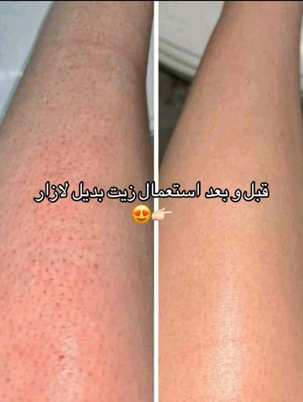 Comparaison avant et après l'utilisation du زيت بديل الليزر pour une peau lisse.